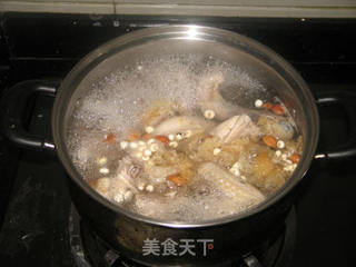 秋天的靓汤--川贝银耳炖鹧鸪的做法步骤:4