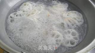 蒜香藕片的做法步骤:3